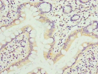 Immunohistochemistry (Formalin/PFA-fixed paraffin-embedded sections) - Anti-KIF1B antibody (AB234869)