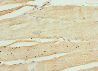Immunohistochemistry (Formalin/PFA-fixed paraffin-embedded sections) - Anti-KIF1B antibody (AB234869)