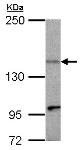 Western blot - Anti-KIF1C antibody (AB125903)