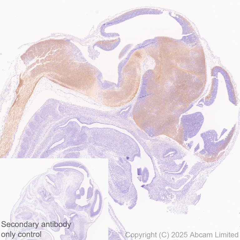 Immunohistochemistry (Formalin/PFA-fixed paraffin-embedded sections) - Anti-KIF21B antibody [EPR30126-519] (AB325182)