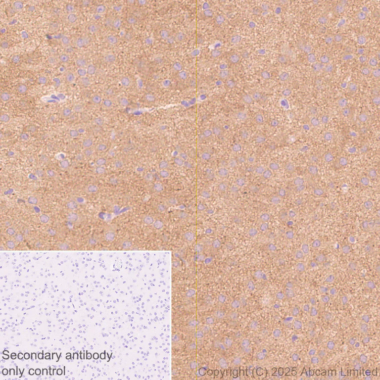 Immunohistochemistry (Formalin/PFA-fixed paraffin-embedded sections) - Anti-KIF21B antibody [EPR30126-519] (AB325182)