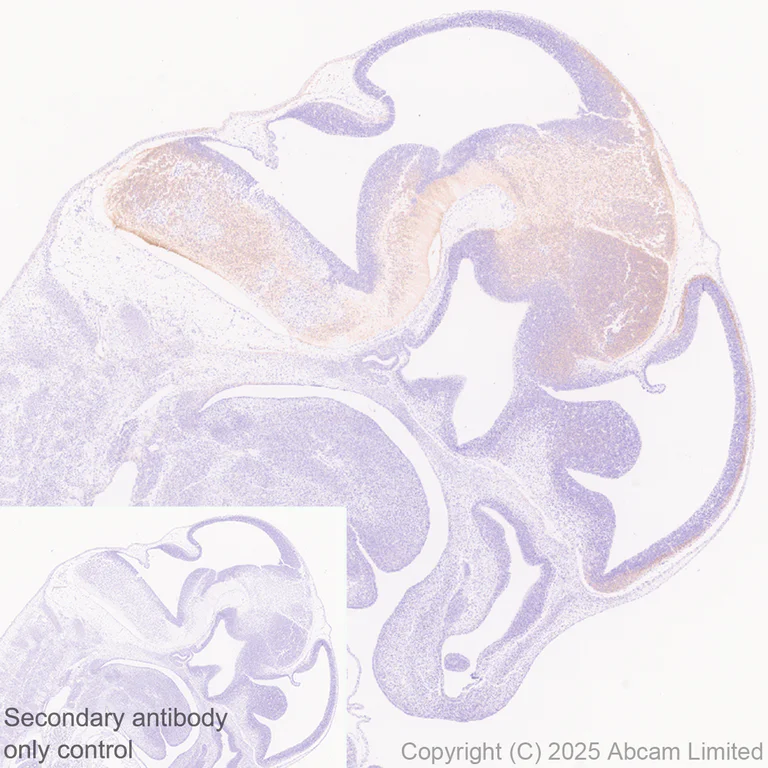 Immunohistochemistry (Formalin/PFA-fixed paraffin-embedded sections) - Anti-KIF21B antibody [EPR30126-519] (AB325182)