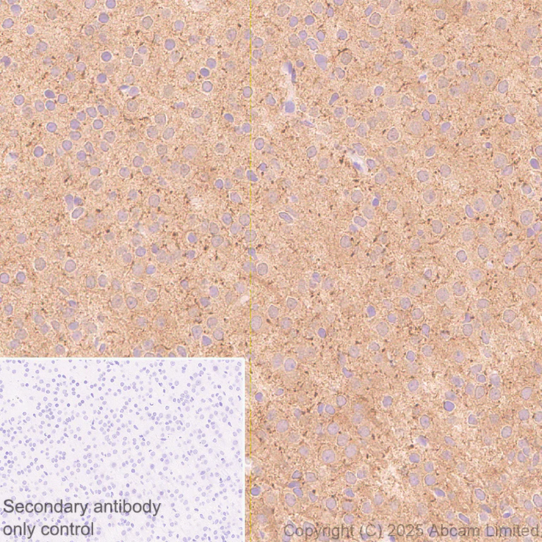 Immunohistochemistry (Formalin/PFA-fixed paraffin-embedded sections) - Anti-KIF21B antibody [EPR30126-519] (AB325182)