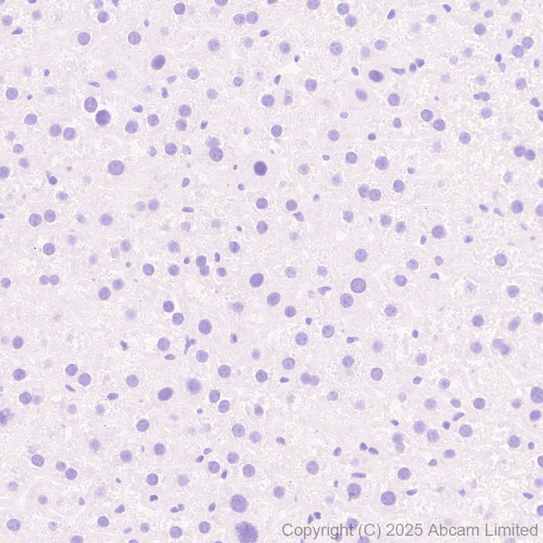 Immunohistochemistry (Formalin/PFA-fixed paraffin-embedded sections) - Anti-KIF21B antibody [EPR30126-519] (AB325182)