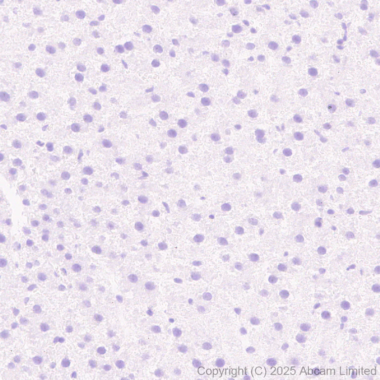 Immunohistochemistry (Formalin/PFA-fixed paraffin-embedded sections) - Anti-KIF21B antibody [EPR30126-519] (AB325182)