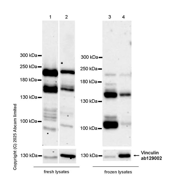 Western blot - Anti-KIF21B antibody [EPR30126-519] (AB325182)