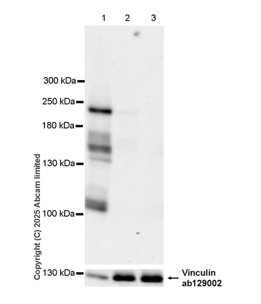 Western blot - Anti-KIF21B antibody [EPR30126-519] (AB325182)