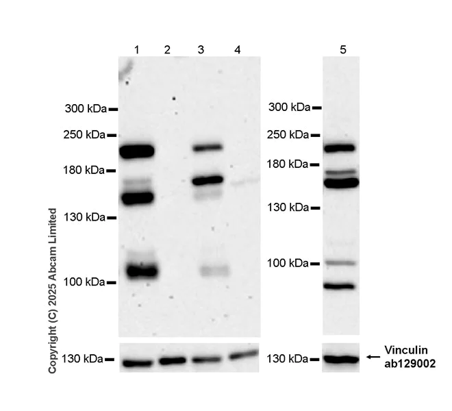 Western blot - Anti-KIF21B antibody [EPR30126-519] (AB325182)