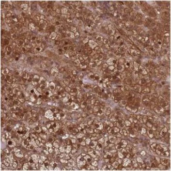 Immunohistochemistry (Formalin/PFA-fixed paraffin-embedded sections) - Anti-KIF26A antibody (AB150966)