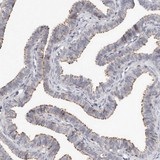 Immunohistochemistry (Formalin/PFA-fixed paraffin-embedded sections) - Anti-KIF26B antibody (AB121952)