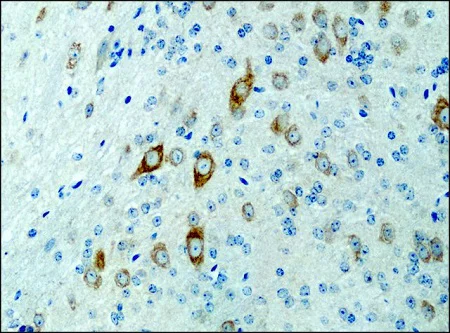 Immunohistochemistry (Formalin/PFA-fixed paraffin-embedded sections) - Anti-KIF3A antibody (AB11259)