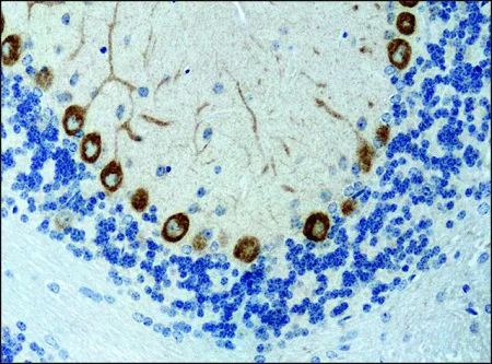 Immunohistochemistry (Formalin/PFA-fixed paraffin-embedded sections) - Anti-KIF3A antibody (AB11259)