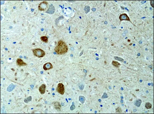 Immunohistochemistry (Formalin/PFA-fixed paraffin-embedded sections) - Anti-KIF3A antibody (AB11259)
