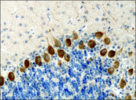 Immunohistochemistry (Formalin/PFA-fixed paraffin-embedded sections) - Anti-KIF3A antibody (AB11259)