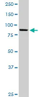 Western blot - Anti-KIF3B antibody (AB89278)
