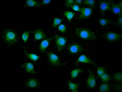 Immunocytochemistry/ Immunofluorescence - Anti-KIF3C antibody (AB236748)