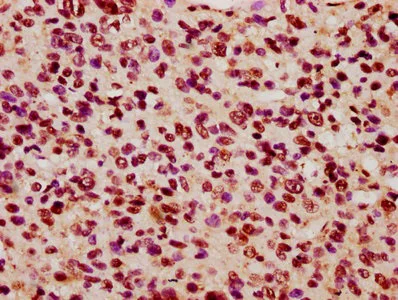 Immunohistochemistry (Formalin/PFA-fixed paraffin-embedded sections) - Anti-KIF3C antibody (AB236748)