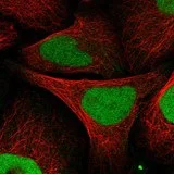 Immunocytochemistry/ Immunofluorescence - Anti-KIF4A/KIF4 antibody (AB122227)