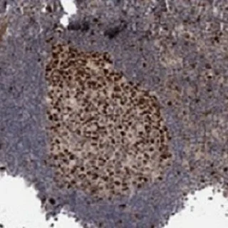 Immunohistochemistry (Formalin/PFA-fixed paraffin-embedded sections) - Anti-KIF4A/KIF4 antibody (AB122227)