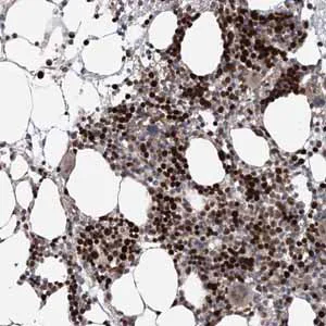 Immunohistochemistry (Formalin/PFA-fixed paraffin-embedded sections) - Anti-KIF4A/KIF4 antibody (AB122227)