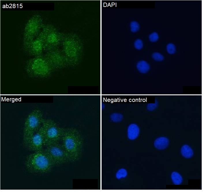 Immunocytochemistry/ Immunofluorescence - Anti-KIF4A/KIF4 antibody (AB3815)
