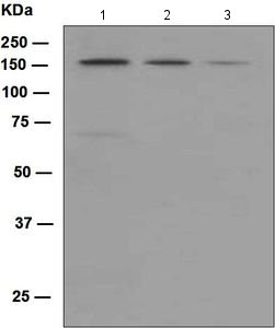 Western blot - Anti-KIF4A/KIF4 antibody [EPR5459] (AB124903)