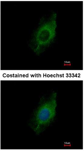 Immunocytochemistry/ Immunofluorescence - Anti-KIF5A antibody (AB154414), expandable thumbnail