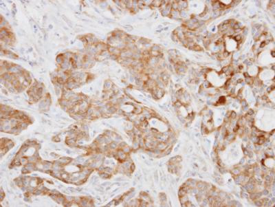 Immunohistochemistry (Formalin/PFA-fixed paraffin-embedded sections) - Anti-KIF5A antibody (AB154414), expandable thumbnail
