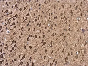 Immunohistochemistry (Formalin/PFA-fixed paraffin-embedded sections) - Anti-KIF5A antibody (AB154414)