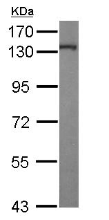Western blot - Anti-KIF5A antibody (AB154414), expandable thumbnail