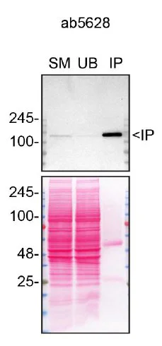 Immunoprecipitation - Anti-KIF5A antibody (AB5628)