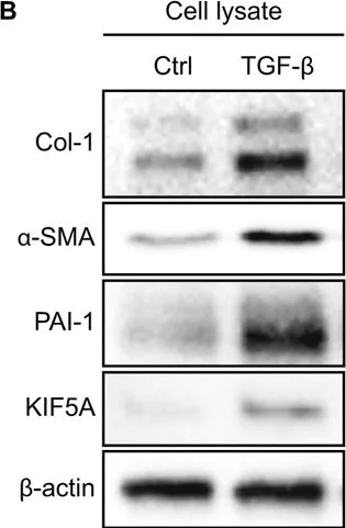 Western blot - Anti-KIF5A antibody (AB5628)