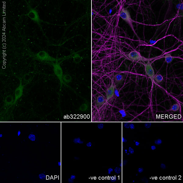 Immunocytochemistry/ Immunofluorescence - Anti-KIF5A antibody [EPR29540-31] (ab322900), expandable thumbnail