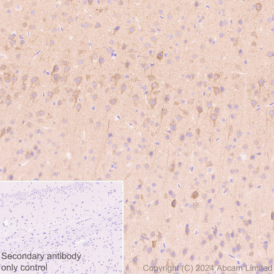 Immunohistochemistry (Formalin/PFA-fixed paraffin-embedded sections) - Anti-KIF5A antibody [EPR29540-31] (ab322900), expandable thumbnail
