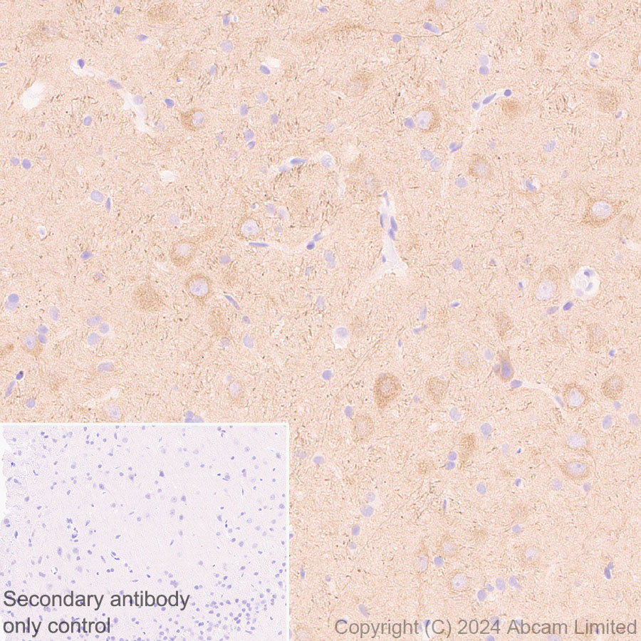 Immunohistochemistry (Formalin/PFA-fixed paraffin-embedded sections) - Anti-KIF5A antibody [EPR29540-31] (ab322900), expandable thumbnail