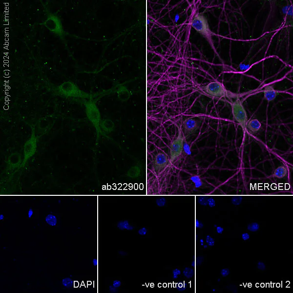 Immunocytochemistry/ Immunofluorescence - Anti-KIF5A antibody [EPR29540-31] - BSA and Azide free (AB324809)