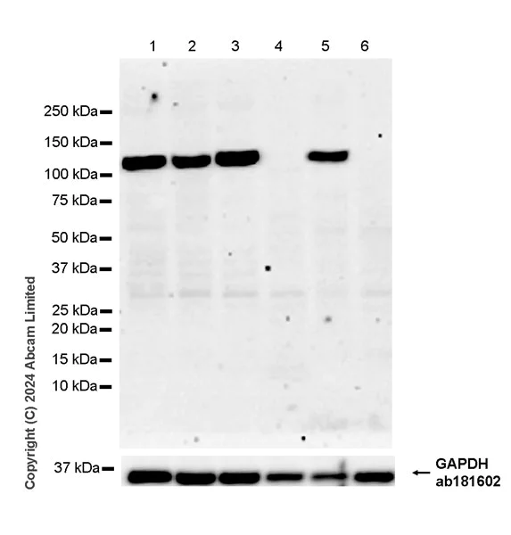 Western blot - Anti-KIF5A antibody [EPR29540-31] - BSA and Azide free (AB324809)