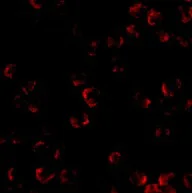 Immunocytochemistry/ Immunofluorescence - Anti-KIF5A + KIF5B + KIF5C antibody (AB62104)