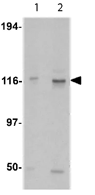 Western blot - Anti-KIF5A + KIF5B + KIF5C antibody (AB62104)