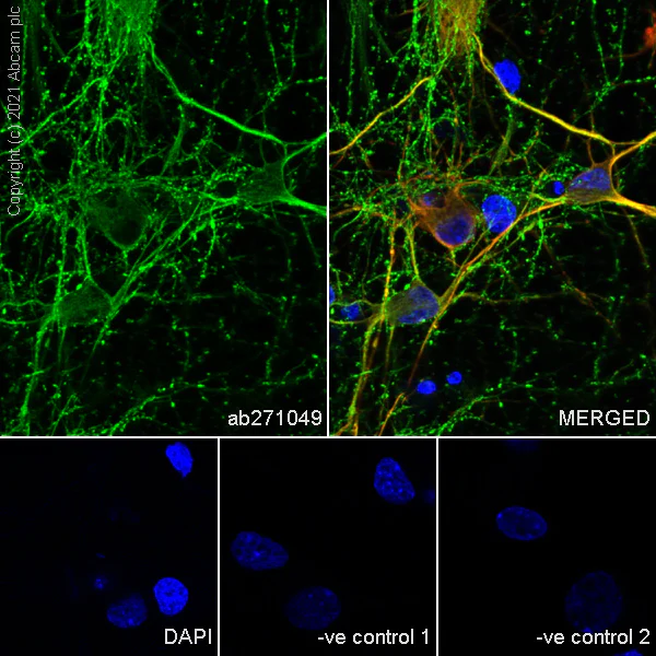 Immunocytochemistry/ Immunofluorescence - Anti-KIF5A + KIF5B + KIF5C antibody [EPR24325-98] (AB271049)