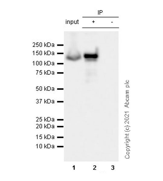 Immunoprecipitation - Anti-KIF5A + KIF5B + KIF5C antibody [EPR24325-98] - BSA and Azide free (ab283661), expandable thumbnail