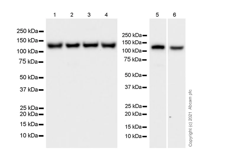 Western blot - Anti-KIF5A + KIF5B + KIF5C antibody [EPR24325-98] - BSA and Azide free (AB283661)