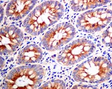 Immunohistochemistry (Formalin/PFA-fixed paraffin-embedded sections) - Anti-KIF5B antibody [EPR10277(B)] - BSA and Azide free (AB249004)