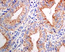 Immunohistochemistry (Formalin/PFA-fixed paraffin-embedded sections) - Anti-KIF5B antibody [EPR10277(B)] - BSA and Azide free (AB249004)