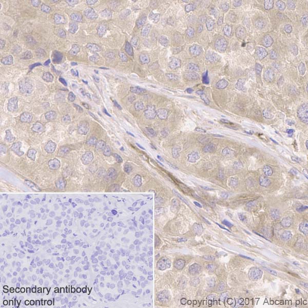 Immunohistochemistry (Formalin/PFA-fixed paraffin-embedded sections) - Anti-KIF5B+KIF5C antibody [EPR10276(B)] (AB167429), expandable thumbnail
