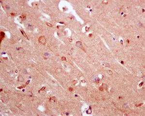 Immunohistochemistry (Formalin/PFA-fixed paraffin-embedded sections) - Anti-KIF5B+KIF5C antibody [EPR10276(B)] - BSA and Azide free (AB232350)