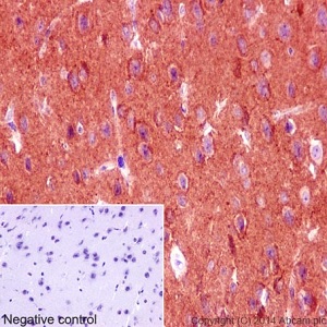 Immunohistochemistry (Formalin/PFA-fixed paraffin-embedded sections) - Anti-KIF5C antibody [EPR16224-32] (AB193352)