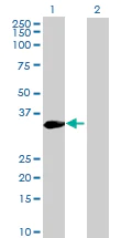 Western blot - Anti-KIF6/Kinesin-13 antibody (AB72702)