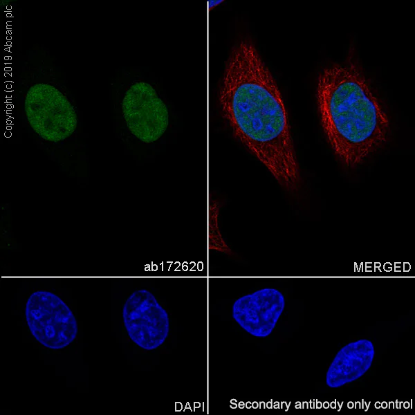 Immunocytochemistry/ Immunofluorescence - Anti-KIFC1 antibody [11445] (AB172620)