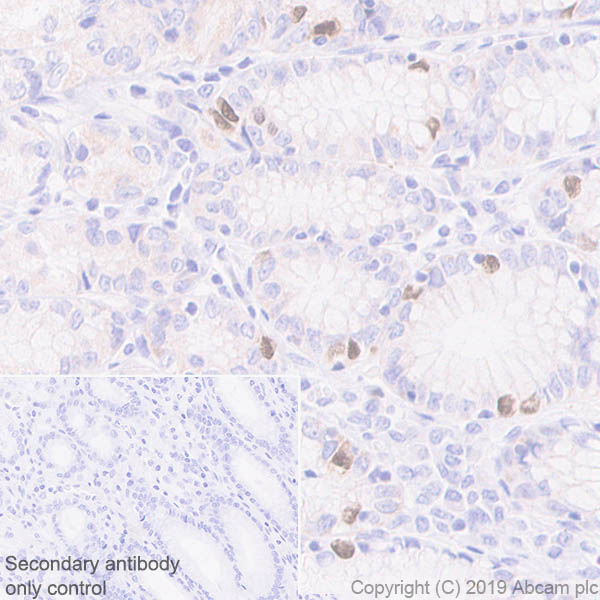 Immunohistochemistry (Formalin/PFA-fixed paraffin-embedded sections) - Anti-KIFC1 antibody [11445] (AB172620)